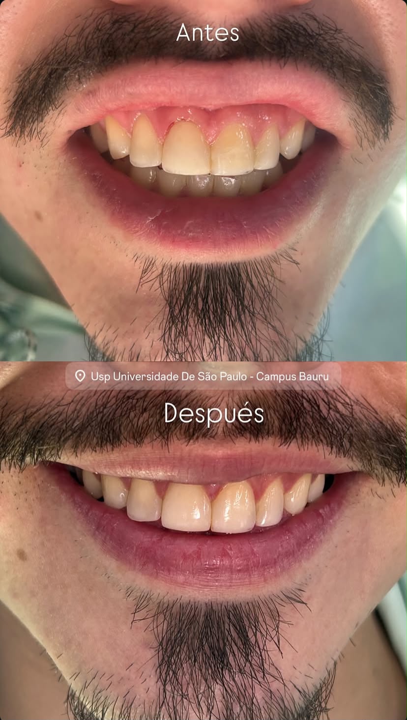 Sonrisa antes del tratamiento